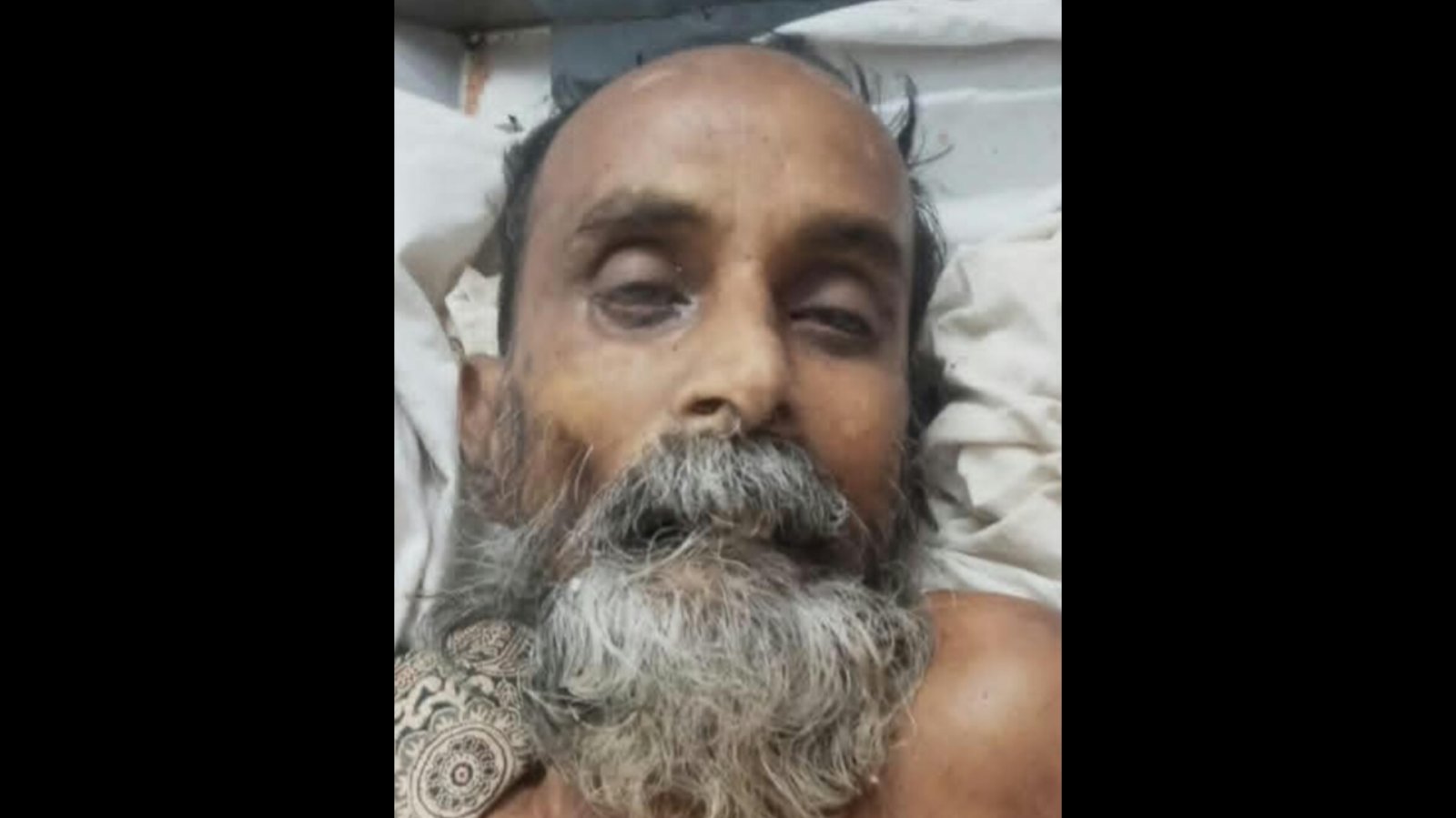 ওসমানী হাসপাতালে মৃত অজ্ঞাতনামা পুরুষের পরিচয় জানতে চায় পুলিশ