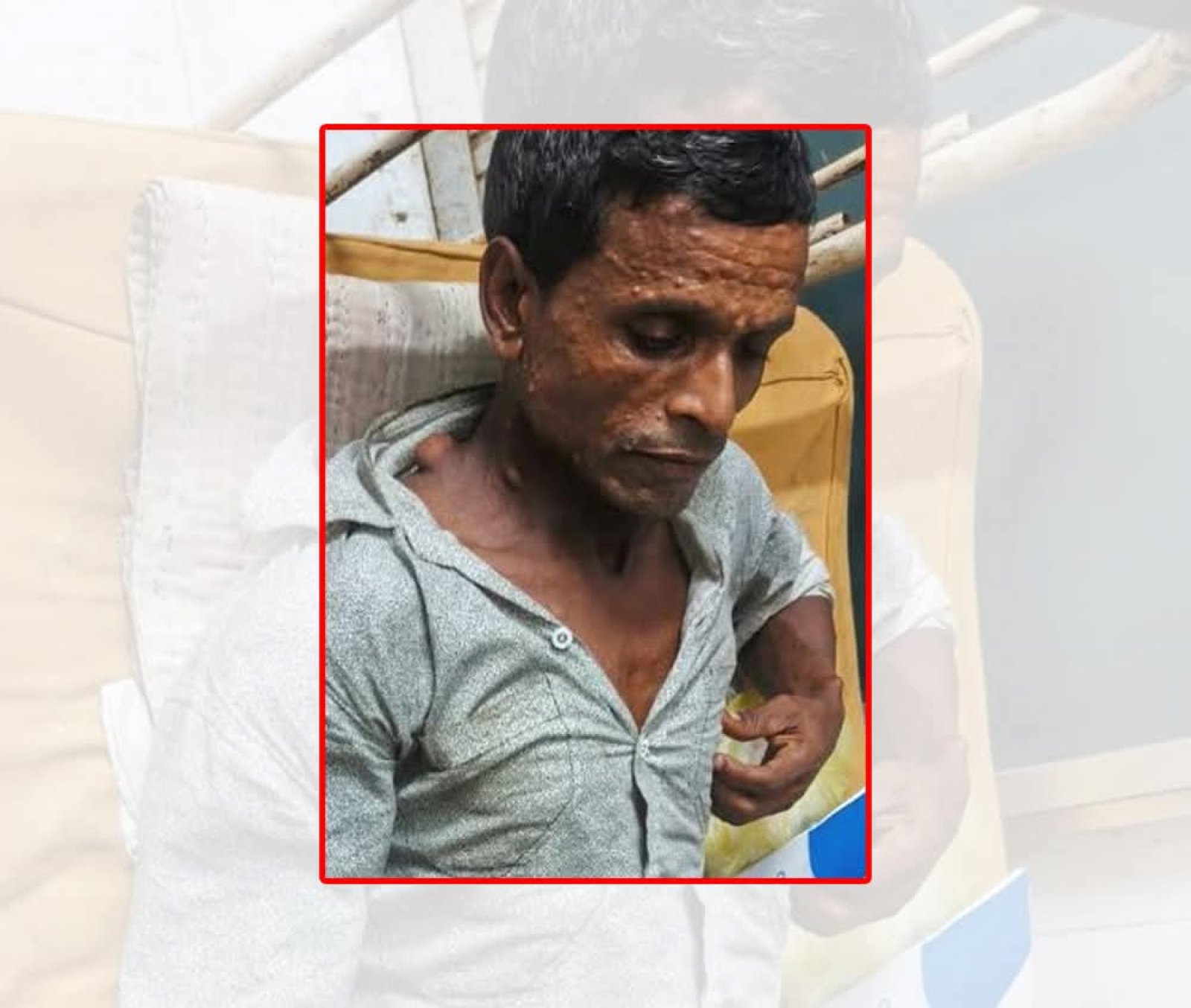 অর্থাভাবে থমকে ছিল অপারেশন, নাজিমের পাশে দাঁড়াল মস্তফা–লিলা ফাউন্ডেশন