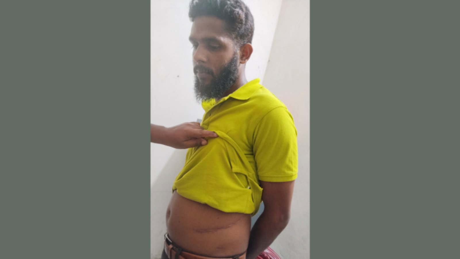 অভাবের তাড়নায় কিডনি বিক্রি, ট্রান্সফরমার চুরির মামলায় গ্রেপ্তারের পর চাঞ্চল্য