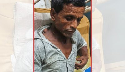অর্থাভাবে থমকে ছিল অপারেশন, নাজিমের পাশে দাঁড়াল মস্তফা–লিলা ফাউন্ডেশন