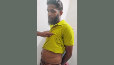 অভাবের তাড়নায় কিডনি বিক্রি, ট্রান্সফরমার চুরির মামলায় গ্রেপ্তারের পর চাঞ্চল্য