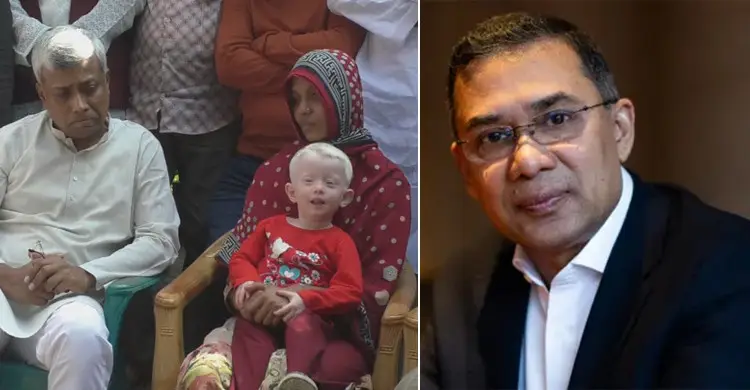 গায়ের রংয়ের কারণে পিতার ফেলে যাওয়া সেই শিশুর পাশে তারেক রহমান