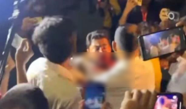 জাপা কার্যালয়ের সামনে সংঘর্ষে গুরুতর আহত নুরুল হক নুর